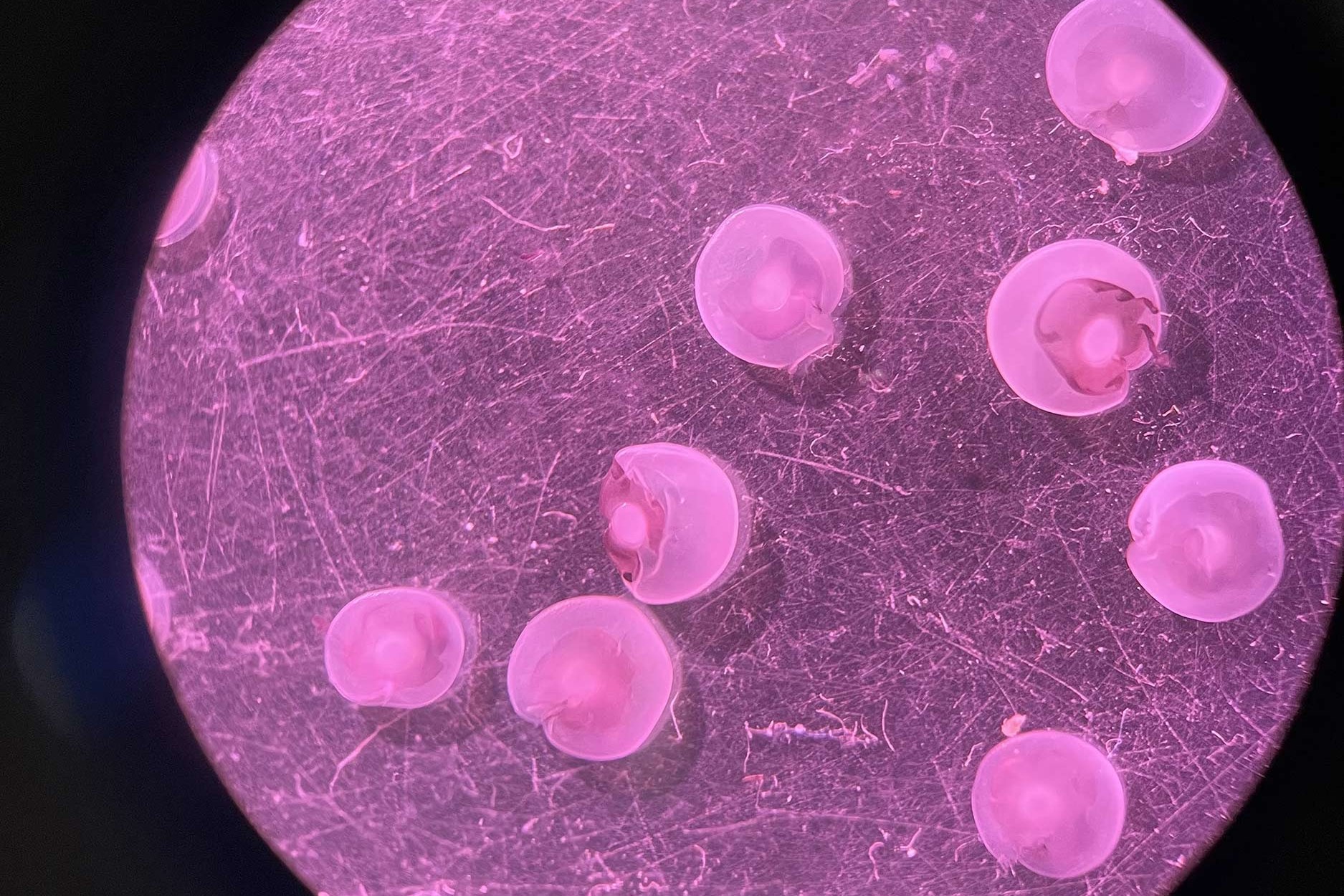 Retinas seen through microscope